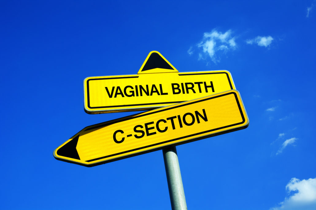 Pregnancy after Csection MyBump2Baby
