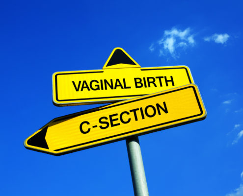 Pregnancy after C-section from MB2B