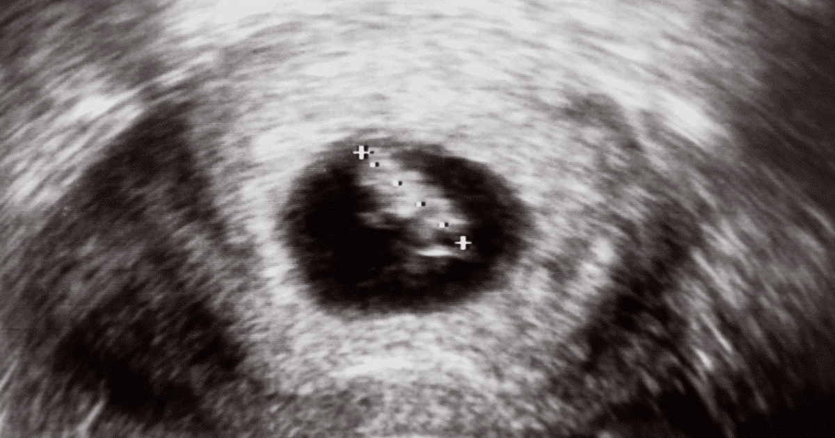 Забеременела в 8. 8 Недель беременности фото.