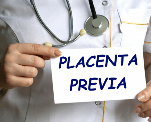 placenta previa - my story