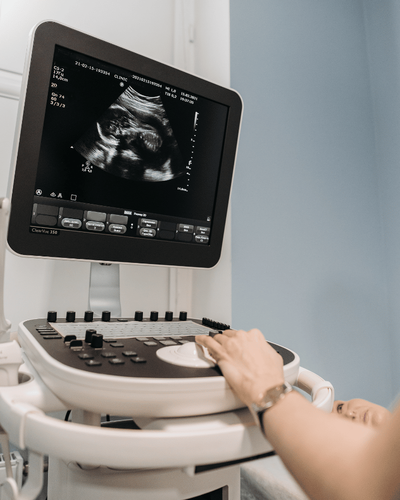 ultrasound tests pregnancy