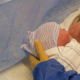 how to keep c section incision dry when overweight
