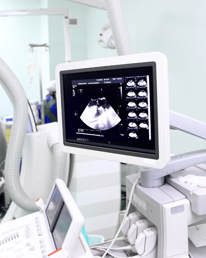 routine ultrasound scan pregnancy