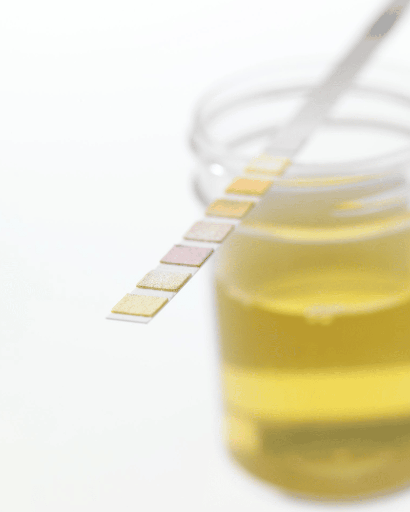 urine test in pregnancy