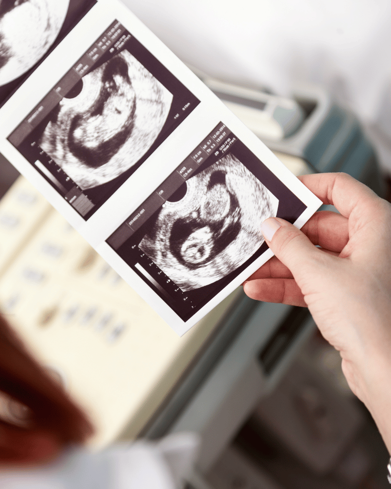attending ultrasound scans pregnancy