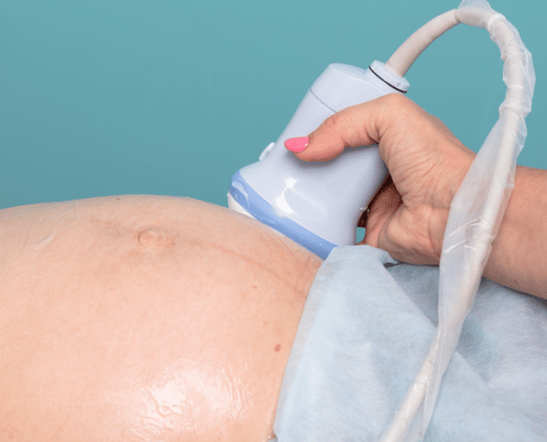 9 week ultrasound scan