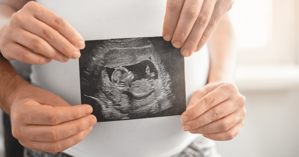 13 week ultrasound scan