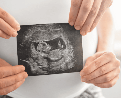 13 week ultrasound scan