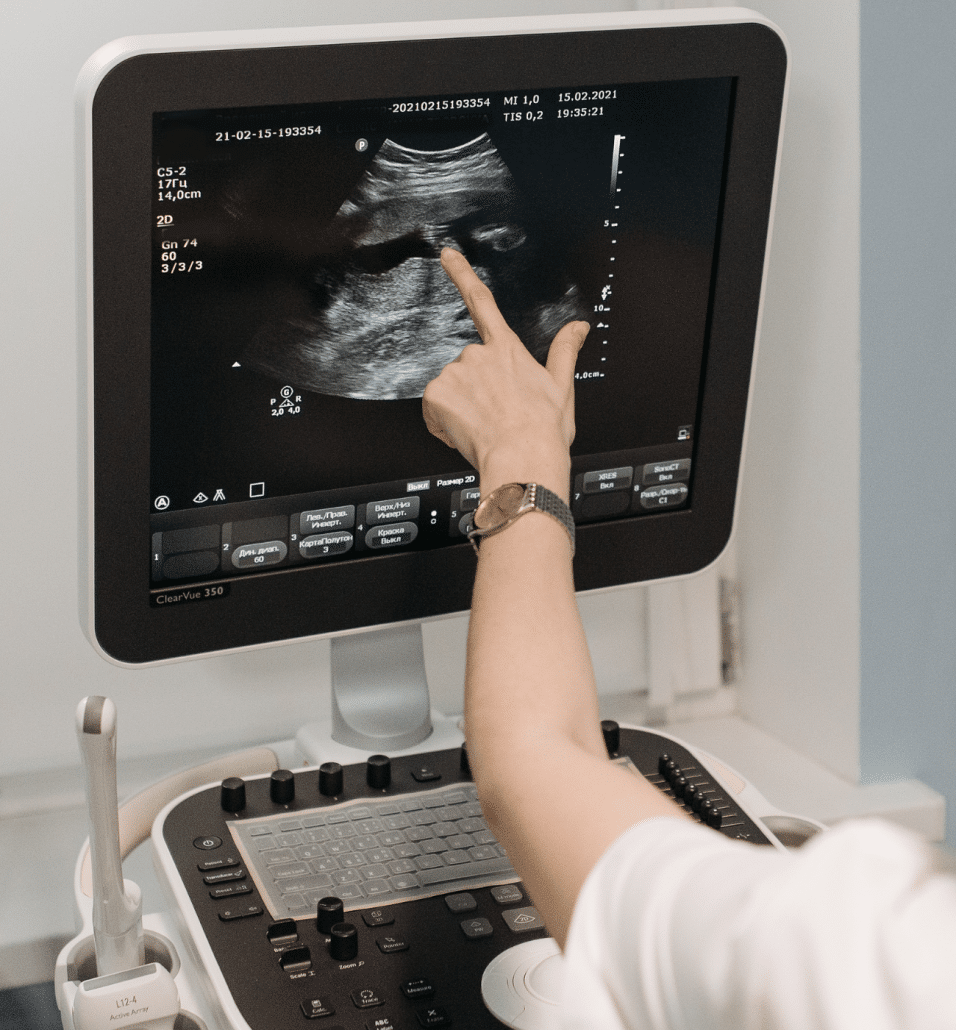 ultrasound technology
